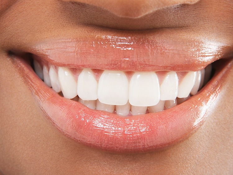 close up of smiling woman with white teeth