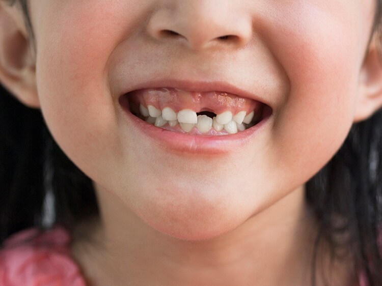 toddler missing front tooth smiling
