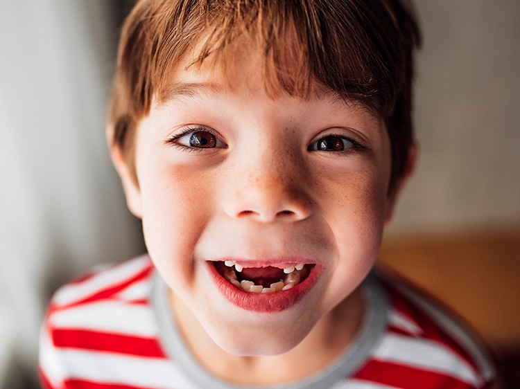 toddler smiling with missing teeth