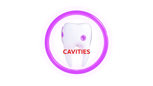 Cavity