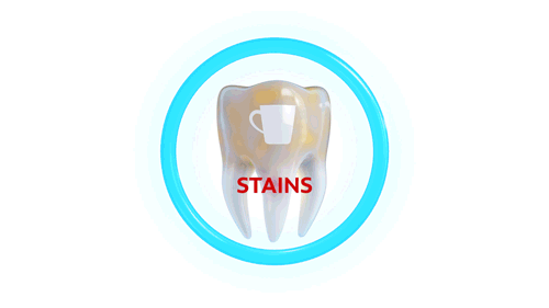 Stains