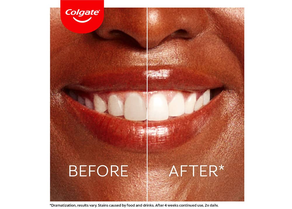 Before and after 
