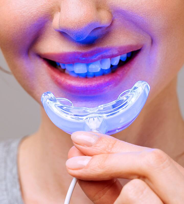 Whitening tips for your big day