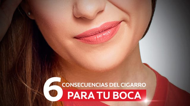 Consejos para tu boca