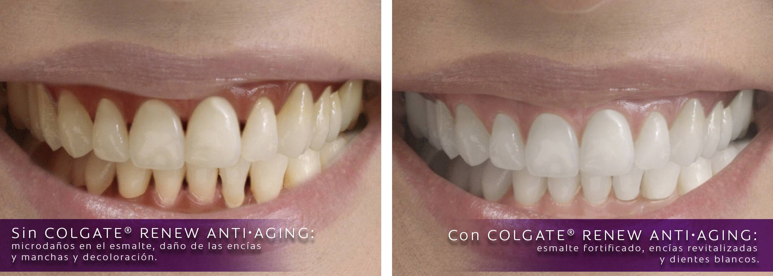 Color natural de los dientes