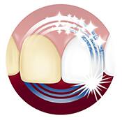 Beneficio whitening