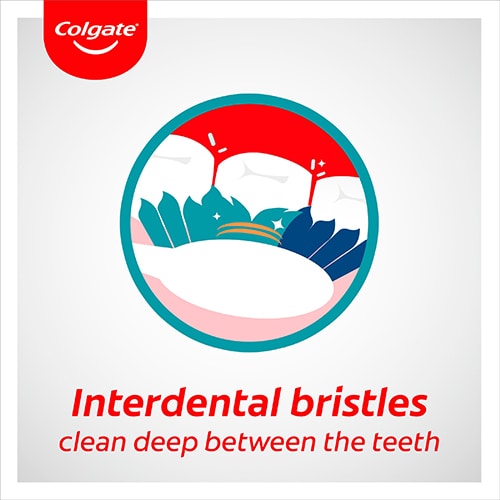 Interdental bristles clean deep between the teeth