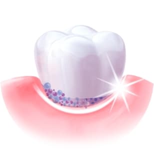 Benefit 1 Colgate Instant Relief Gum Care