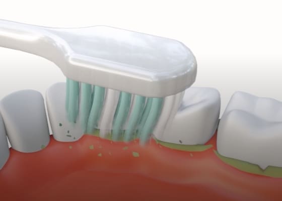 Super soft bristles for gentle deep clean