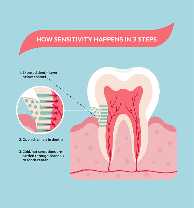 Tooth Sensitivity