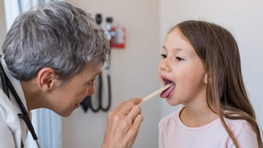 Doctor examined tonsil stones bad breath