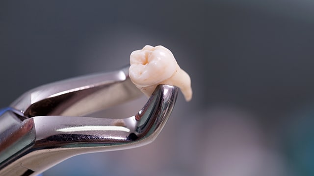 Dental equipment holding extracted tooth