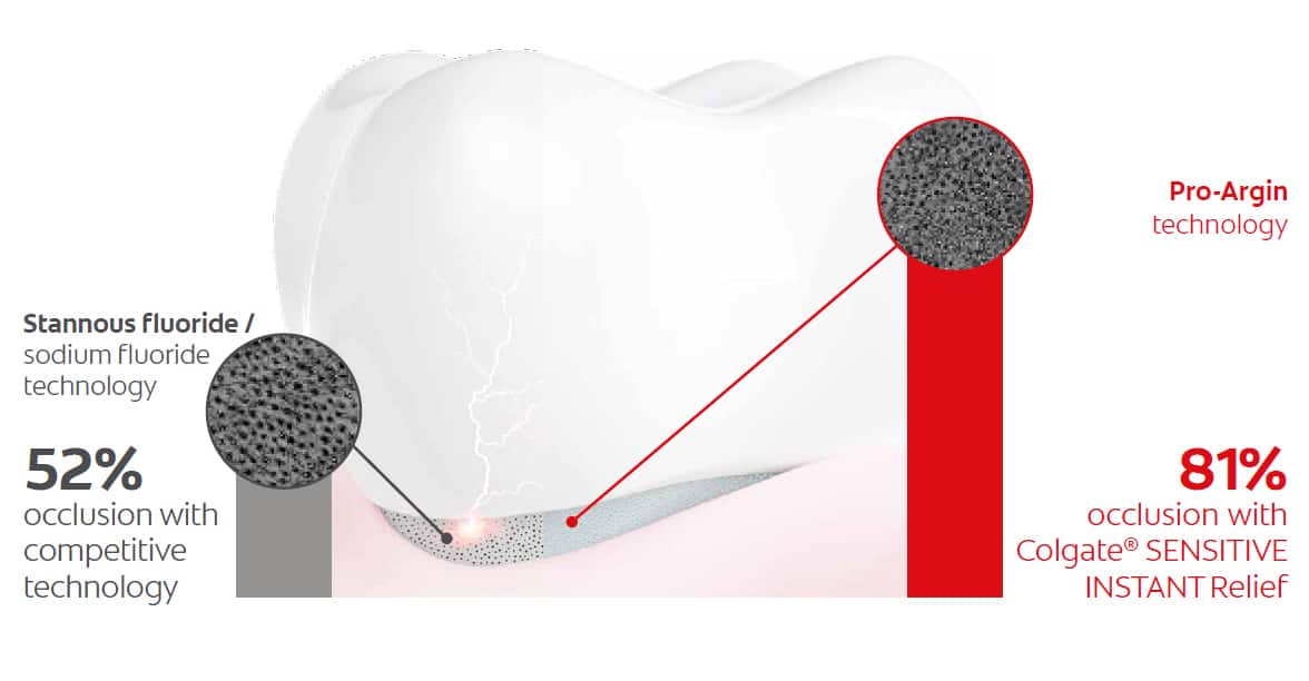 Superior tubuli occlusion
