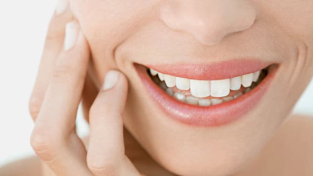 Smiling woman with bright white teeth after professional treatment – Teeth whitening cost and pricing options.