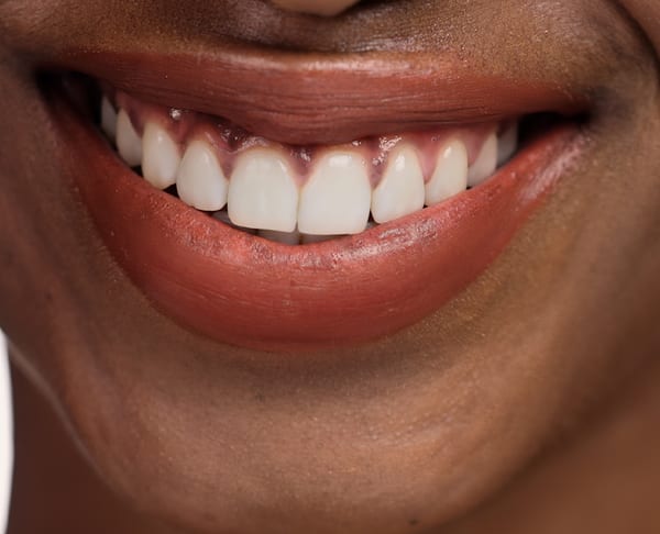 100% of people had a healthier mouth