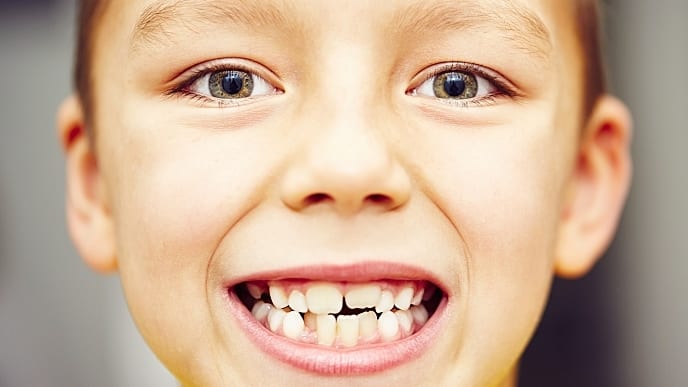 çarpık dişleri olan çocuk