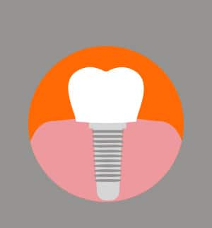 implante dental