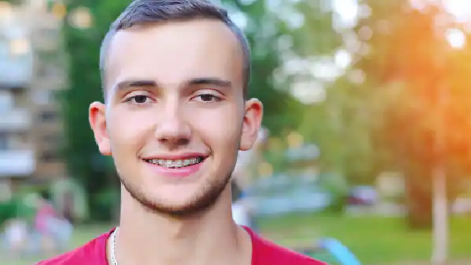 Joven con brackets cerámicos