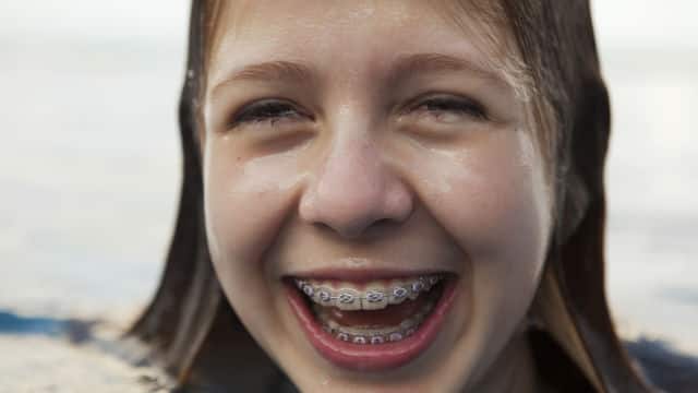 girl in a swimming pool with braces smiling brightly