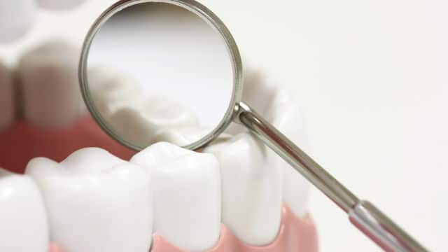 Guarding Smiles: The Significance of Regular Dental Sealants