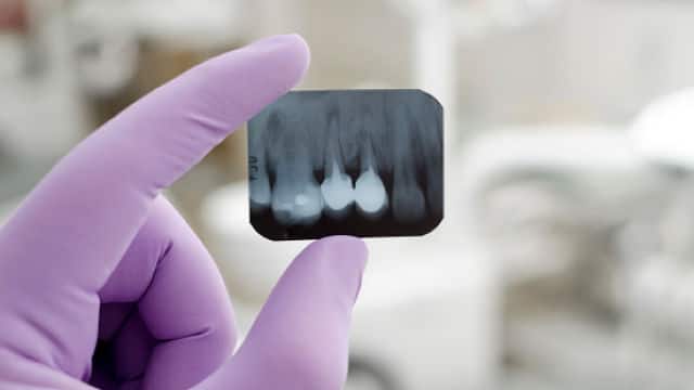 a dental x-ray strip