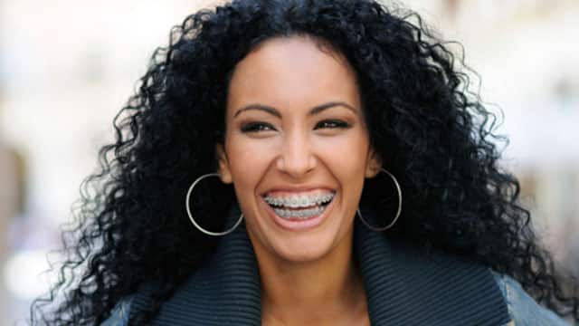 A woman is wearing braces and smiling