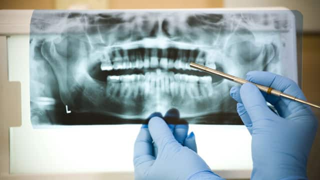 diş hekimi diş röntgenini gözden geçiriyor