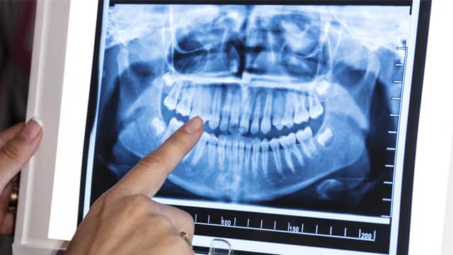 A dentist reviews a panoramic dental x-ray on a screen