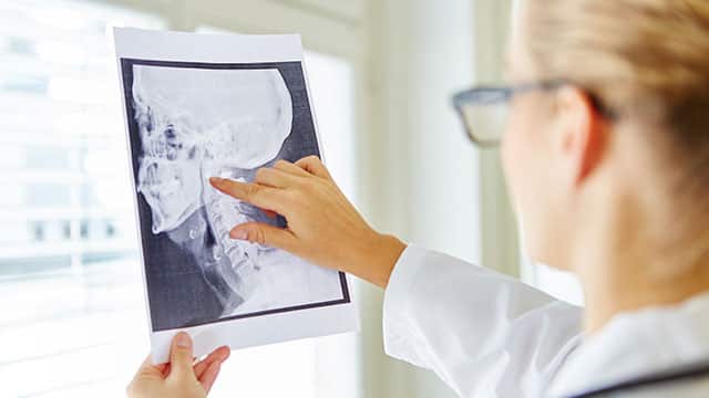 Doctor revisando radiogradía corporal