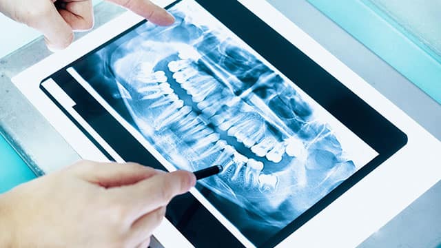 Dentist examining dental x-ray