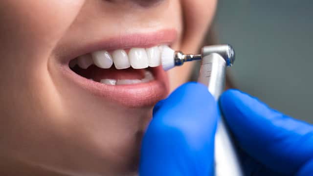 A close-up of a woman getting her teeth cleaned by a dental hygienist