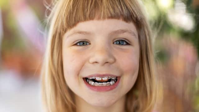 Young girl with bangs smiling with braces