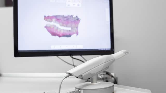 A dental scanner with a 3D rendering of teeth