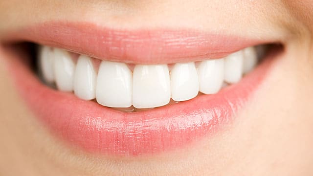 Angular cheilitis causes discount