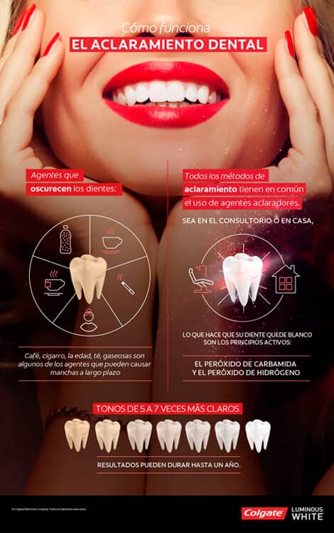 infografía de aclaramiento dental