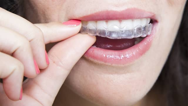 a close up of a woman putting on her retainer