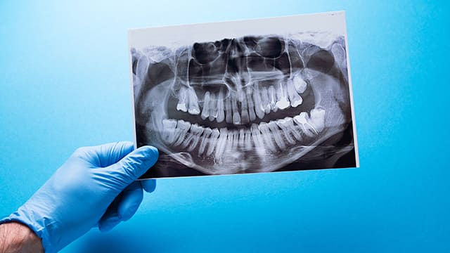 Radiografía dental