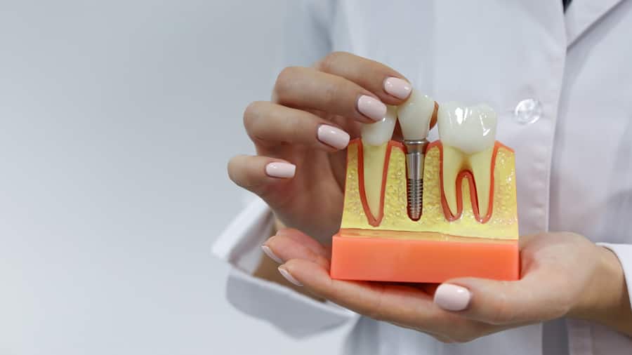 شتلاند يدع مجالا للشك الأفيون  كيف تحافظ على صحة أسنانك الداعمة أو زرع السن | كولجيت®