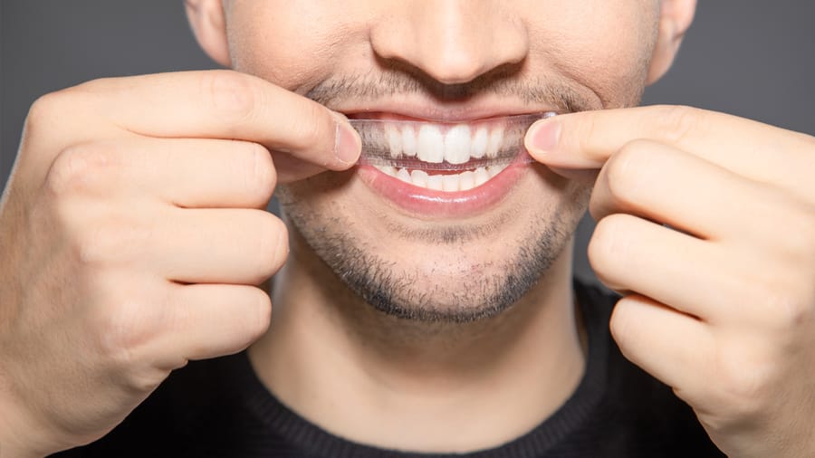 الاسنان تبييض دليل إرشادات