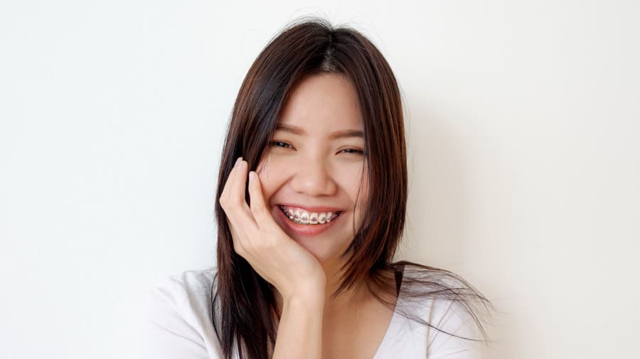 how to choose a perfect braces color for you - colgate ph how to choose a perfect braces color for you - colgate ph