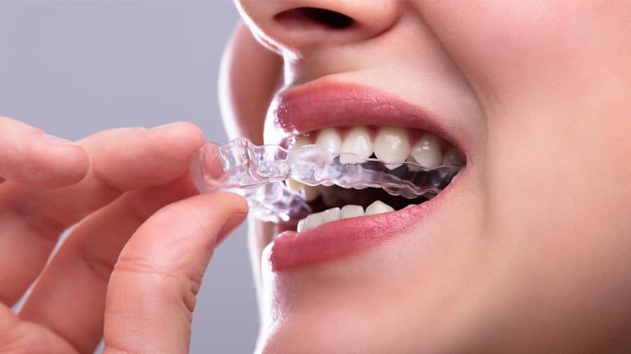 Antibacerial oral hygiene