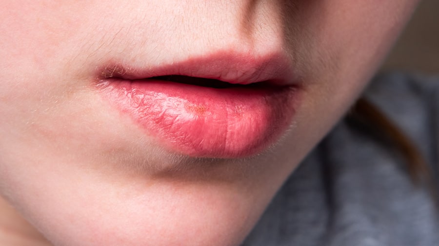 العلاقة بين القلق وجفاف الفم
