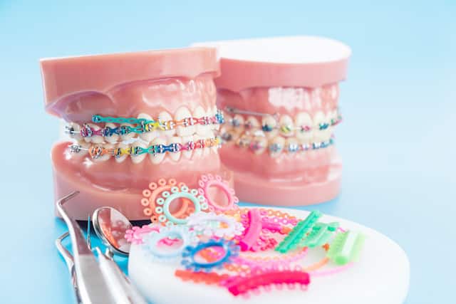 5 common questions about braces for kids - colgate india