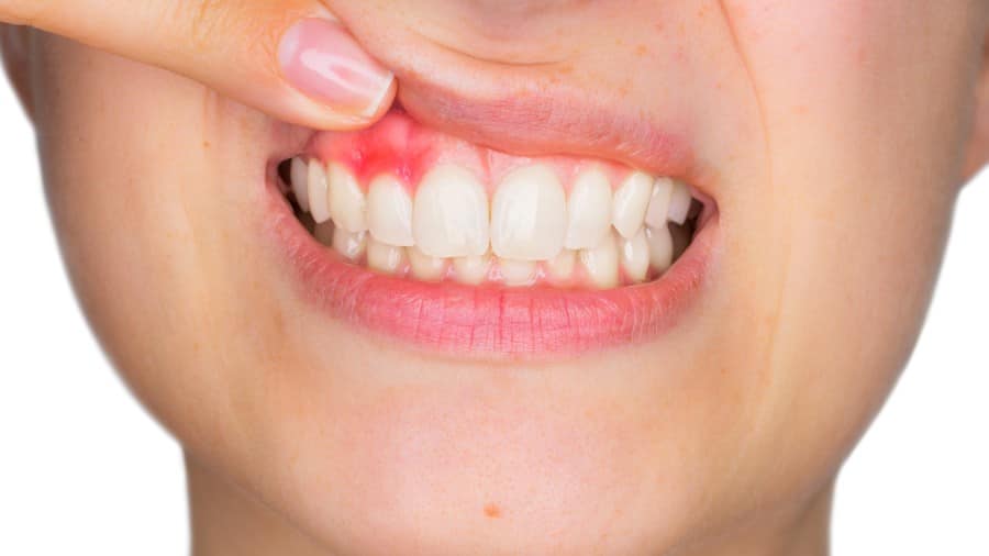 causes and treatments of pain in gums - colgate singapore
