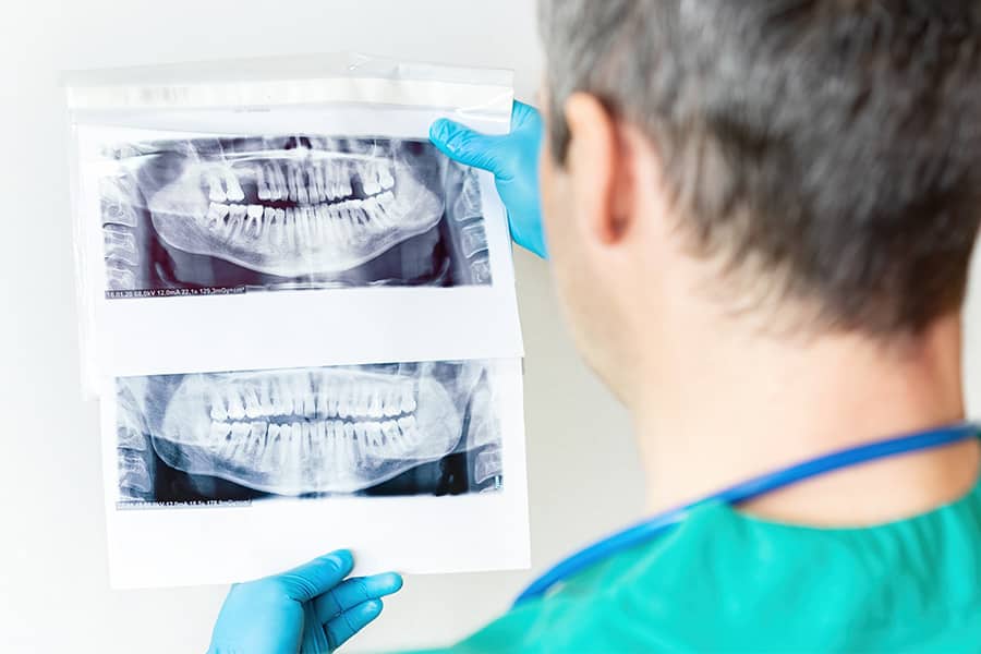Dentist viewing dental x-ray