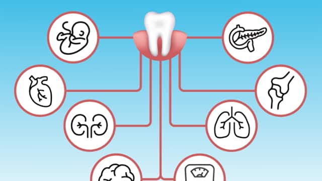 Periodontal disease and your patient   