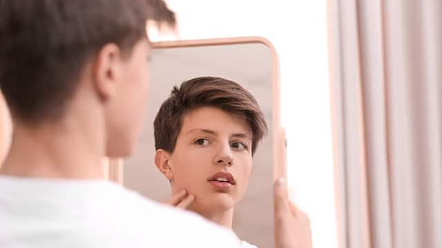 Teenage boy with acne problem looking in mirror at home