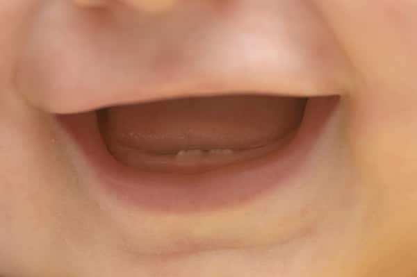 Bebé sonriendo con sus primeros dientes