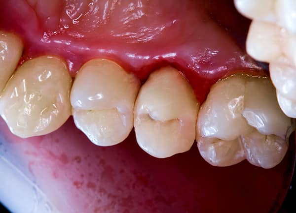 Estructura dental