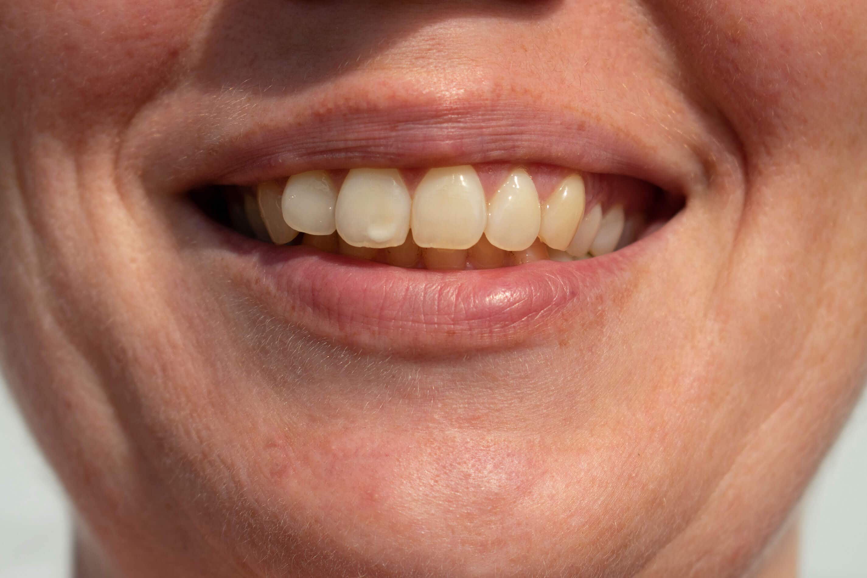 tooth spot women smiles revealing white